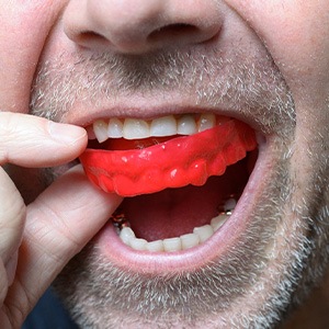 Man removing red mouthguard from upper arch
