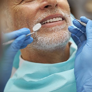 Nose-down view of man with white facial hair about to undergo dental exam