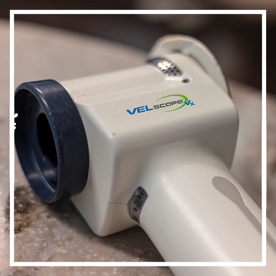 Dentist holding a model of a decayed tooth