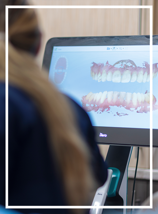 Man looking in a mirror at the empty space in his mouth where a tooth is missing